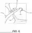 Fig. 07 - MAPPING AND TRANSSEPTAL PUNCTURE CATHETER