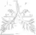Fig. 02 - SYSTEMS AND METHODS FOR LOCALIZED ABLATION WITH A CIRCULATING FLUID CATHETER