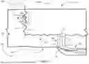 Fig. 07 - NEUROMODULATION CATHETER