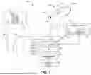 Fig. 02 - SYSTEM AND METHOD FOR ELECTROGRAM-BASED LESION ASSESSMENT