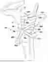 Fig. 01 - METHODS, SYSTEMS AND DEVICES FOR PRE-OPERATIVELY PLANNED SHOULDER SURGERY GUIDES AND IMPLANTS