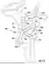 Fig. 08 - METHODS, SYSTEMS AND DEVICES FOR PRE-OPERATIVELY PLANNED SHOULDER SURGERY GUIDES AND IMPLANTS
