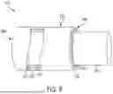 Fig. 09 - DELIVERY AIDS FOR GLAUCOMA SHUNTS