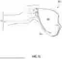 Fig. 22 - METHODS, SYSTEMS, AND/OR DEVICES FOR THERMAL TREATMENTS