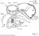 Fig. 02 - HAND CLAMP FOR TRIGGER POINT THERAPY AND ACUPRESSURE