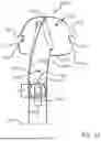 Fig. 09 - HAND CLAMP FOR TRIGGER POINT THERAPY AND ACUPRESSURE
