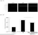 Fig. 08 - COMPOSITION COMPRISING HYBRID EXOSOME