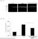 Fig. 09 - COMPOSITION COMPRISING HYBRID EXOSOME
