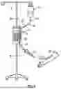 Fig. 02 - ADJUSTMENT OF AN INFUSION PUMP BASED ON PRESSURE CHANGES IN AN INFUSION LINE