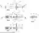 Fig. 08 - DUAL CHAMBER SYRINGE WITH A RESTRICTING ELEMENT AND METHODS OF USE THEREOF
