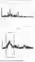 Fig. 06 - A NEBULIZER WITH PLUME DETECTION