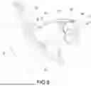 Fig. 06 - SPUTUM SUCTION STRUCTURE OF TRACHEOSTOMY TUBE