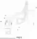 Fig. 07 - SPUTUM SUCTION STRUCTURE OF TRACHEOSTOMY TUBE