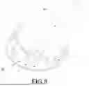 Fig. 09 - SPUTUM SUCTION STRUCTURE OF TRACHEOSTOMY TUBE