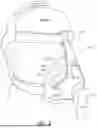 Fig. 04 - SEALING FORCE DETECTION ENABLED, THERAPEUTIC FLUID DELIVERY DEVICE