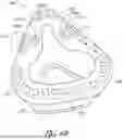 Fig. 07 - SEALING FORCE DETECTION ENABLED, THERAPEUTIC FLUID DELIVERY DEVICE