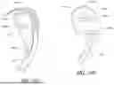 Fig. 17 - SEALING FORCE DETECTION ENABLED, THERAPEUTIC FLUID DELIVERY DEVICE