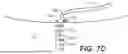 Fig. 19 - DIAGNOSTIC CATHETERS, GUIDE CATHETERS, VISUALIZATION DEVICES AND CHORD MANIPULATION DEVICES, AND RELATED KITS AND METHODS