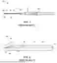 Fig. 02 - Vascular Access Devices Having Curves
