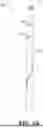 Fig. 03 - Image space controlled manual catheter