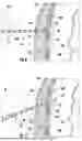 Fig. 06 - DECOMPRESSION NEEDLE ASSEMBLY