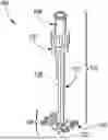 Fig. 01 - SHUNT SYSTEM FOR DRAINING EXCESS CEREBROSPINAL FLUID