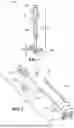 Fig. 02 - SHUNT SYSTEM FOR DRAINING EXCESS CEREBROSPINAL FLUID