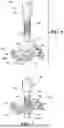 Fig. 04 - SHUNT SYSTEM FOR DRAINING EXCESS CEREBROSPINAL FLUID