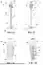 Fig. 09 - SHUNT SYSTEM FOR DRAINING EXCESS CEREBROSPINAL FLUID