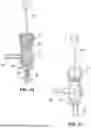 Fig. 33 - SHUNT SYSTEM FOR DRAINING EXCESS CEREBROSPINAL FLUID