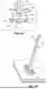 Fig. 35 - SHUNT SYSTEM FOR DRAINING EXCESS CEREBROSPINAL FLUID