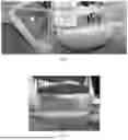 Fig. 02 - A METHOD FOR FIREFIGHTING BY USE OF A FIREFIGHTING FOAM