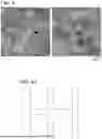 Fig. 07 - ALPHA + BETA TITANIUM ALLOY SHAPE AND METHOD FOR MANUFACTURING THE SAME