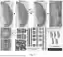 Fig. 04 - SYSTEM AND METHOD FOR TUMOR CHARACTERIZATION