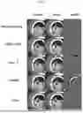 Fig. 07 - METHODS, COMPUTER DEVICES, AND NON-TRANSITORY COMPUTER-READABLE RECORD MEDIA FOR LEARNING OF WATERMARKING MODEL USING COMPLEX ATTACK
