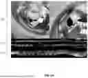 Fig. 06 - THREE-DIMENSIONAL VESSEL CONSTRUCTION FROM INTRAVASCULAR ULTRASOUND IMAGES