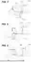 Fig. 07 - IMAGING ELEMENT CLEANING APPARATUS WITH STRUCTURE-MANDATED CLEANING MEMBER MOTION CONTROL