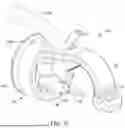 Fig. 11 - ENDOSCOPE ATTACHMENT MECHANISM FOR USE WITH SUTURE BASED CLOSURE DEVICE