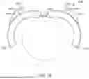 Fig. 29 - ENDOSCOPE ATTACHMENT MECHANISM FOR USE WITH SUTURE BASED CLOSURE DEVICE