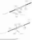 Fig. 09 - SYSTEMS and METHODS FOR REMOVING UNDESIRABLE MATERIAL WITHIN A CIRCULATORY SYSTEM UTILIZING DURING A SURGICAL PROCEDURE