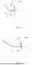 Fig. 08 - DENTAL INSTRUMENT, IMPACTED TOOTH TRACTION DEVICE AND THE INSTALLATION METHOD THEREOF