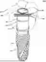 Fig. 01 - DENTAL IMPLANT