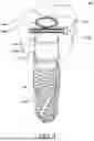 Fig. 02 - DENTAL IMPLANT