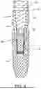 Fig. 08 - DENTAL IMPLANT