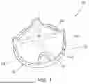 Fig. 02 - MODULAR BIOPROSTHETIC VALVES AND METHODS FOR DESIGNING AND MAKING THEM