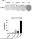 Fig. 02 - BACTERIAL COMPOSITIONS AND METHODS FOR TREATING CANCER AND IMMUNE DISEASES