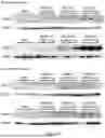 Fig. 06 - RECOMBINANT AAV VECTORS FOR TREATING GLUTARIC ACIDURIA TYPE I