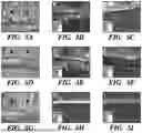 Fig. 08 - Elastic Biopolymer and Use as a Tissue Adhesive