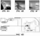Fig. 09 - Elastic Biopolymer and Use as a Tissue Adhesive