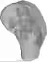 Fig. 01 - MALLEABLE BONE REPAIR MATERIAL